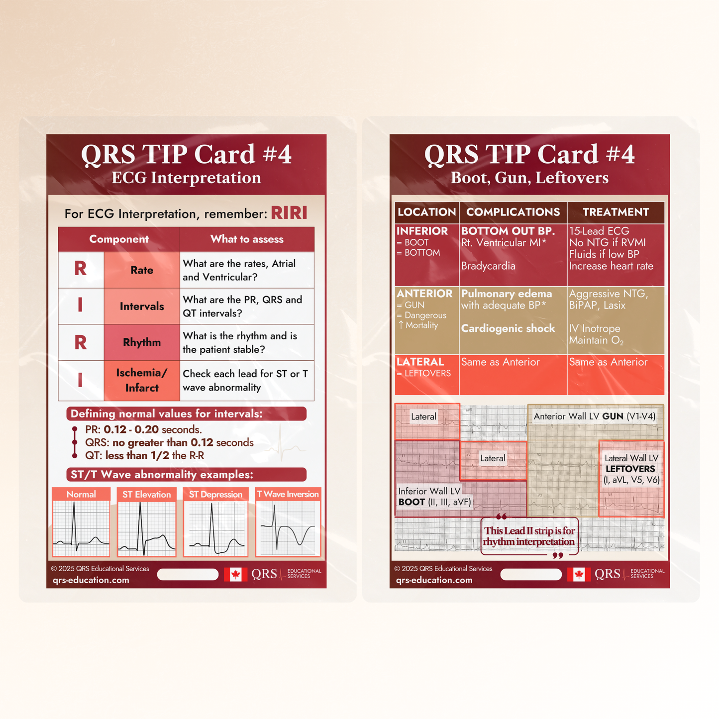 QRS Tips Pocket Cards – Individual Cards