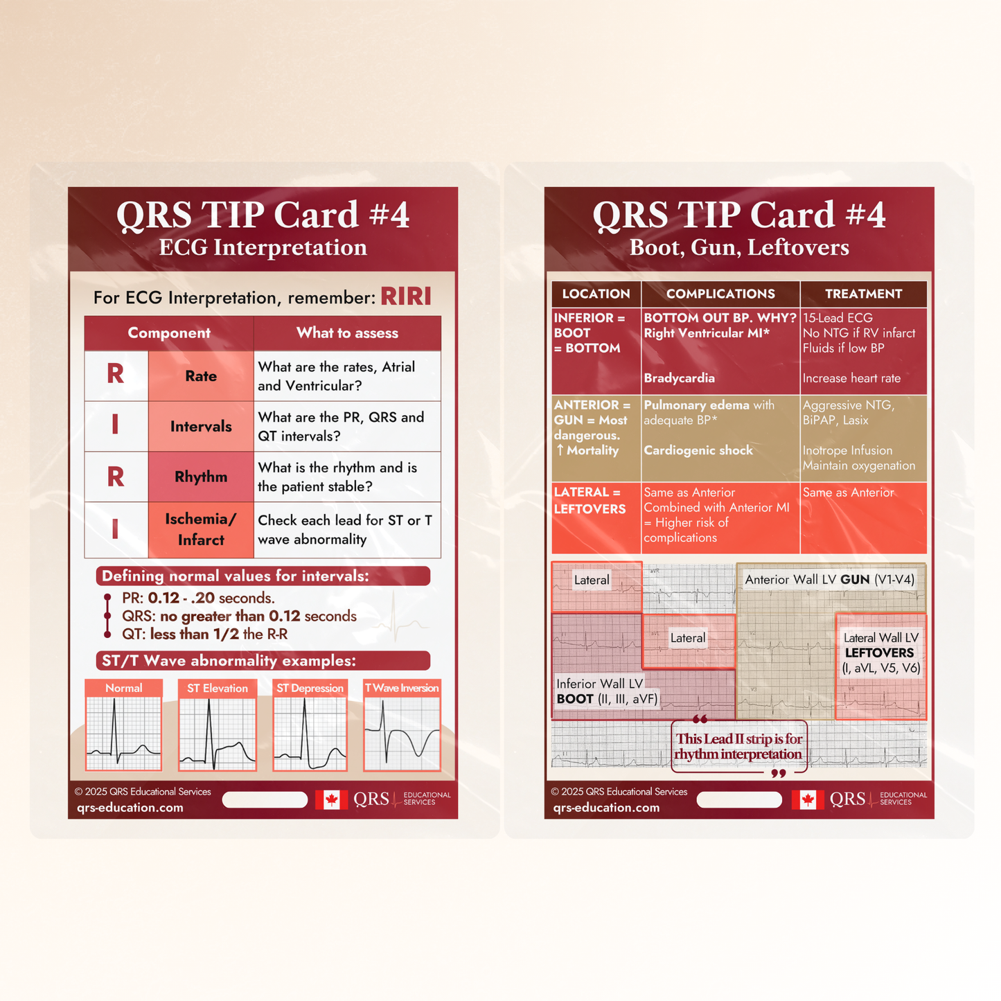 QRS Tips Pocket Cards – Individual Cards