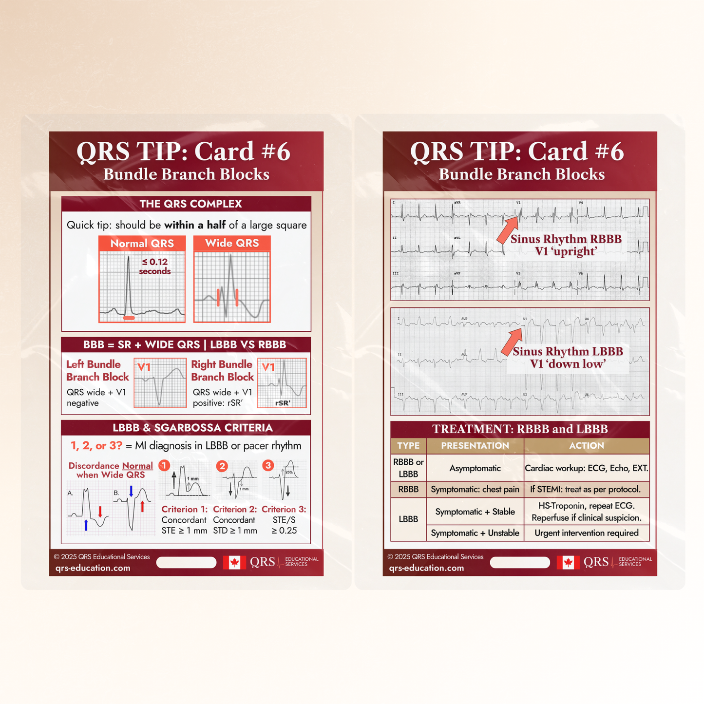 QRS Tips Pocket Cards – Individual Cards