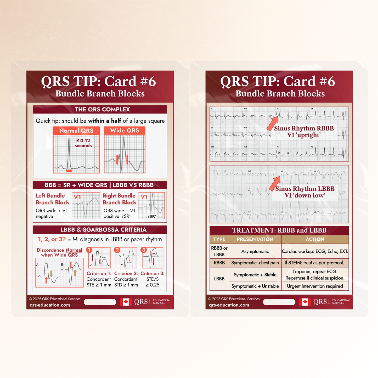 QRS Tips Pocket Cards – Individual Cards